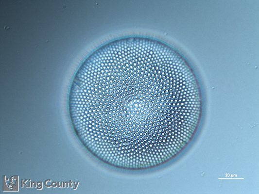 Photo of Coscinodiscus spp.